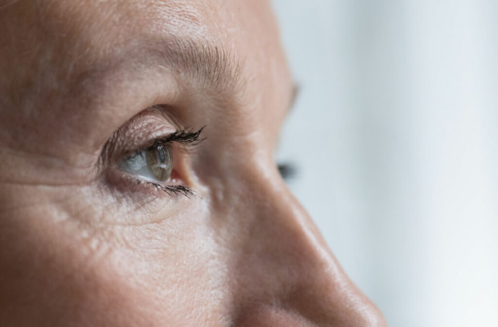 A closeup of the eye of someone suffering from early symptoms of glaucoma