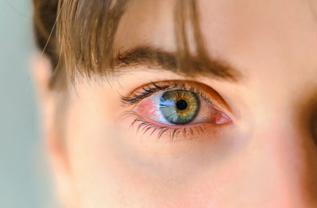 Close-up image of a green eye suffering from redness and irritation.